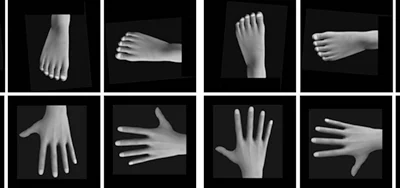 Retraining the Brain: Graded Motor Imagery for Chronic Pain