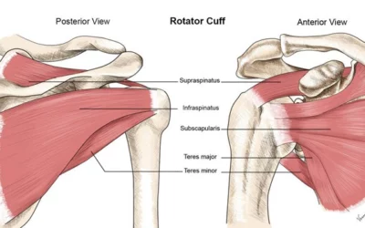 7 Thoughts for Patients with Suspected Rotator Cuff Dysfunction