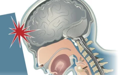 Concussion Management and Rehabilitation – More than Just Rest!