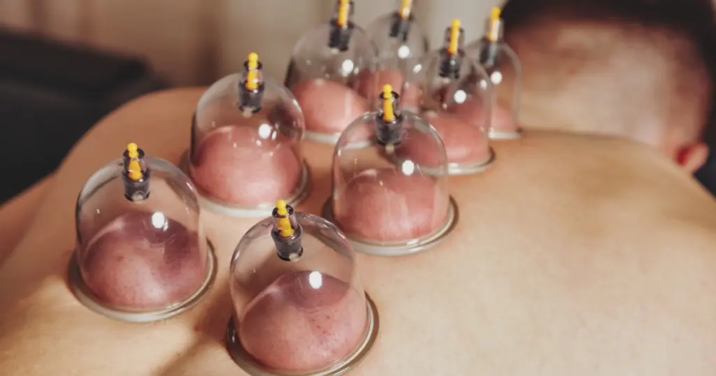 Cupping In Greenville