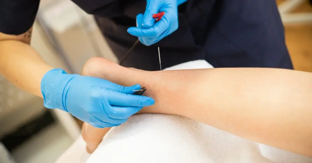 Dry Needling In Greenville